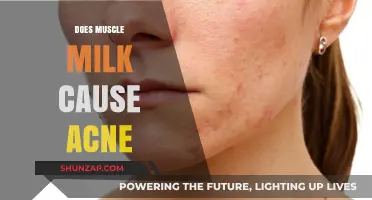 Muscle Milk and Acne: What's the Connection?