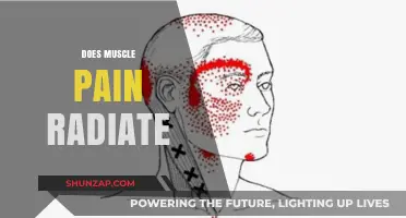 Does Muscle Pain Radiate? Understanding Causes, Spread, and Relief