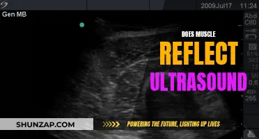 How Muscles Reflect: Ultrasound Insights