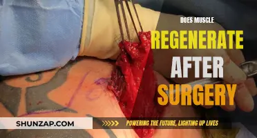 Muscle Regeneration Post-Surgery: What to Expect and How to Help