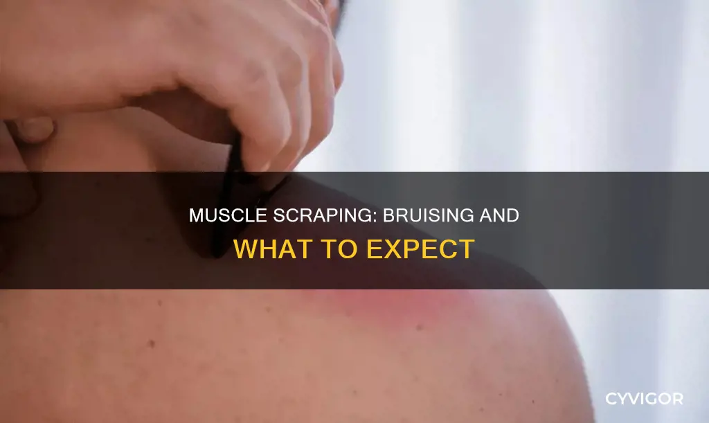 does muscle scraping cause bruising