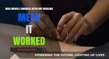 Does Muscle Soreness After Dry Needling Indicate Treatment Success?