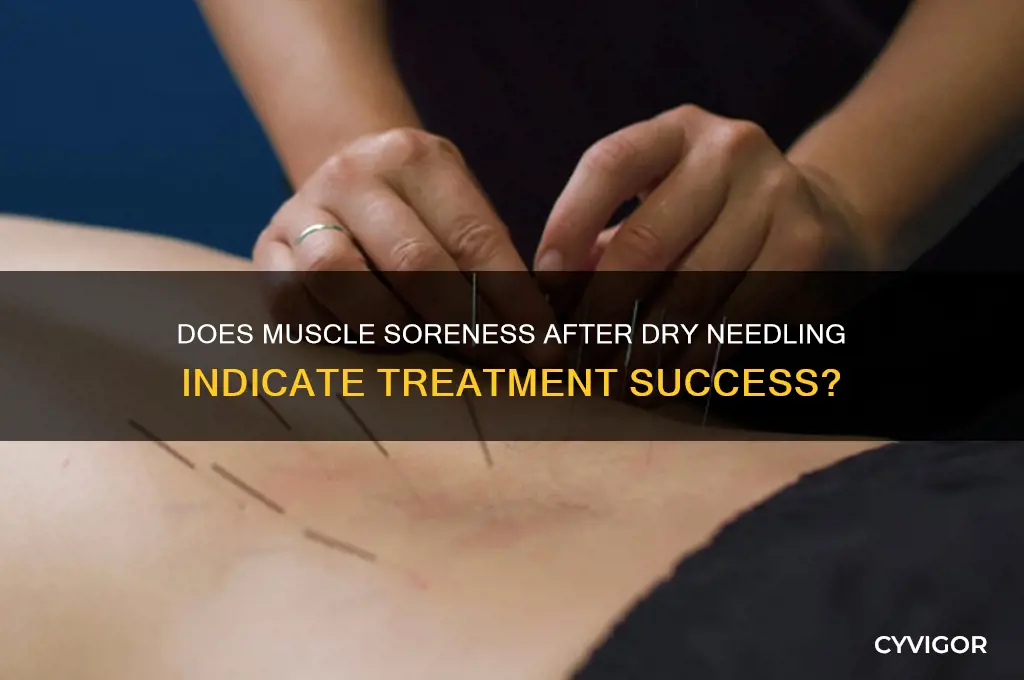 does muscle soreness after dry needling mean it worked