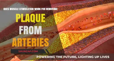 Muscle Stimulation for Artery Plaque Removal: Effective or Myth?