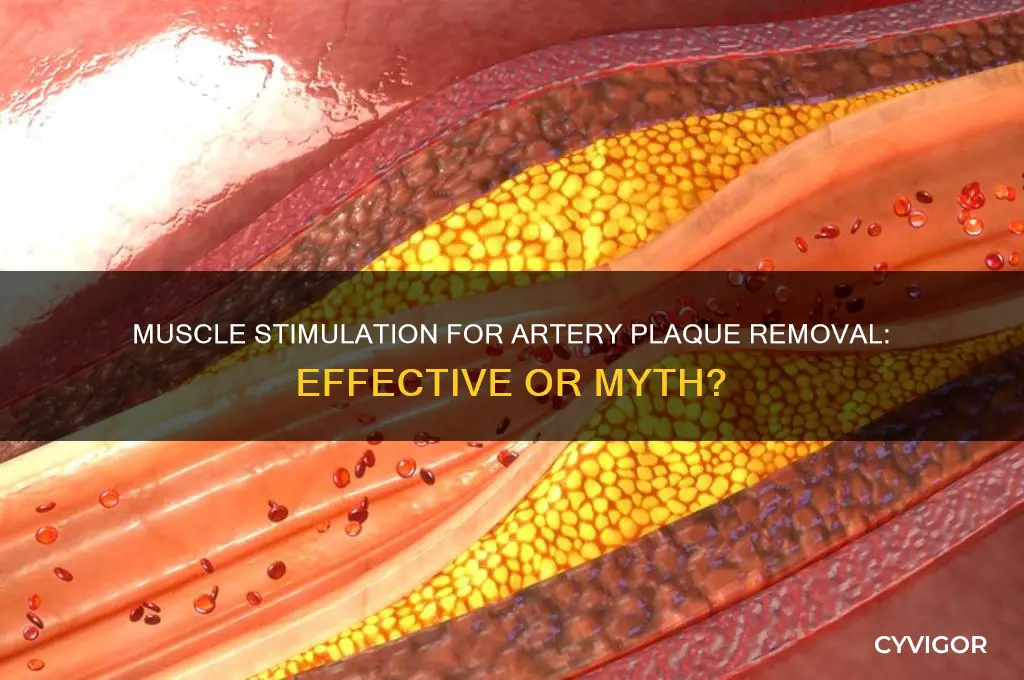 does muscle stimulation work for removing plaque from arteries