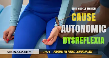 Muscle Stretching and Autonomic Dysreflexia: What's the Link?