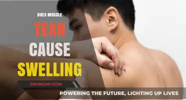 Muscle Tears: Swelling and What to Expect