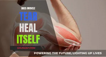 Muscle Tears: Can They Heal Without Intervention?