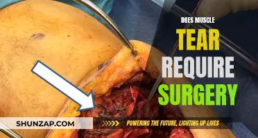 Muscle Tears: When Surgery is the Only Option