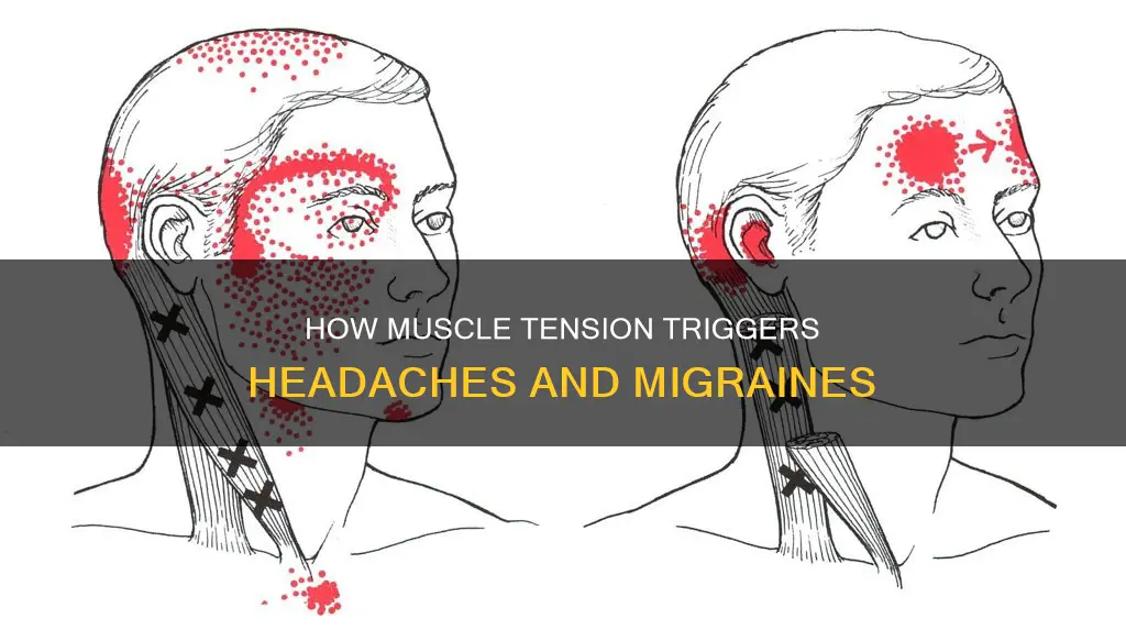 does muscle tension cause headaches