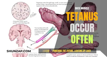 Muscle Tetanus: Uncommon Condition, Understand the Triggers and Risks