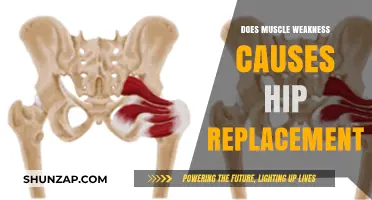 Hip Replacement: Muscle Weakness and Its Role