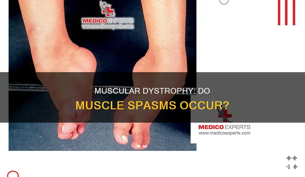 does muscular dystrophy cause muscle spasms
