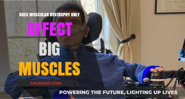 Muscular Dystrophy: Beyond Big Muscles - A Comprehensive Overview