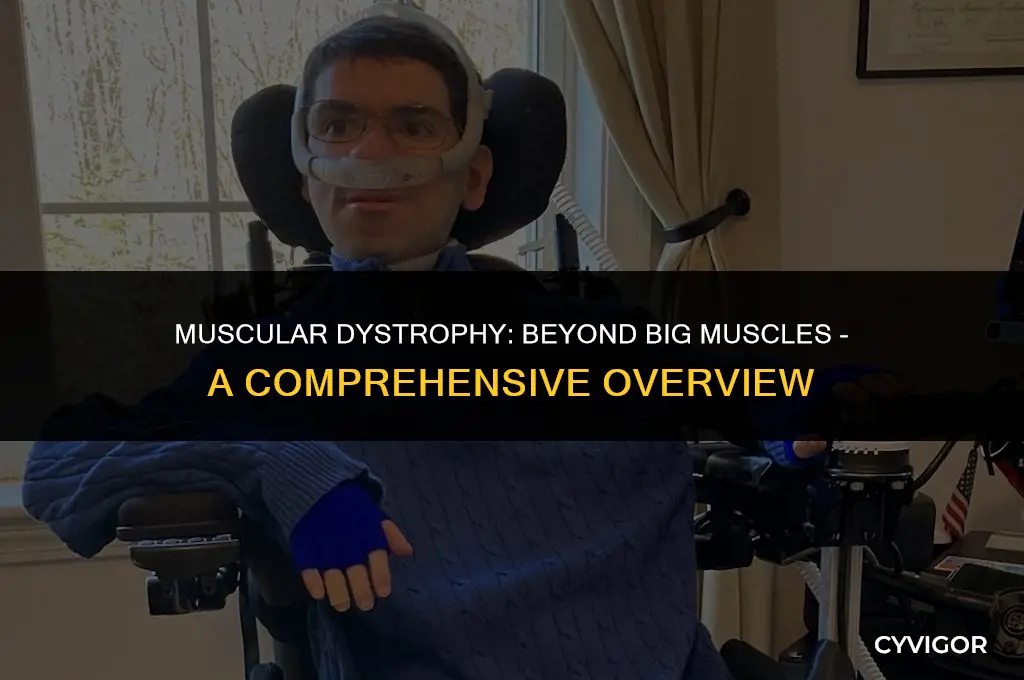 does muscular dystrophy only affect big muscles