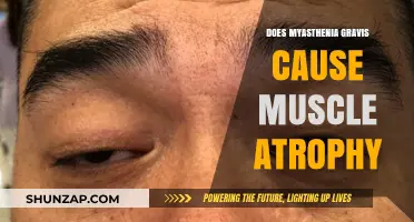 Myasthenia Gravis: Understanding Muscle Atrophy and Its Connection