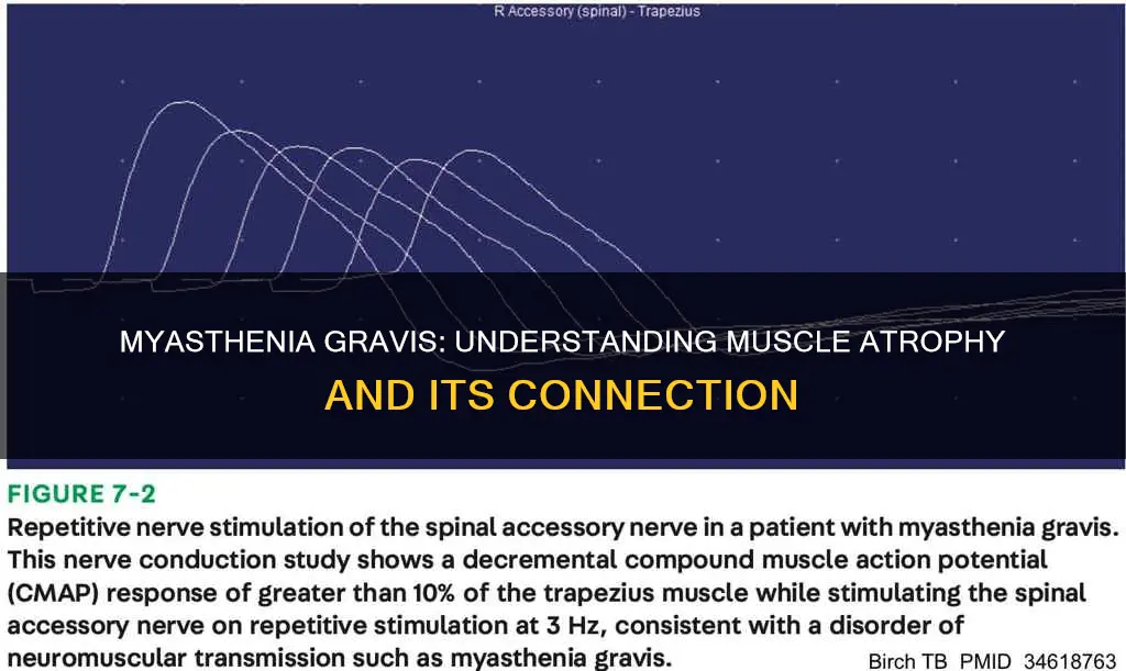 does myasthenia gravis cause muscle atrophy