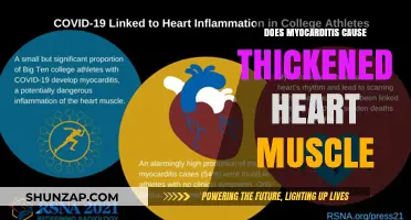 Myocarditis: Thickened Heart Muscle Mystery Explained
