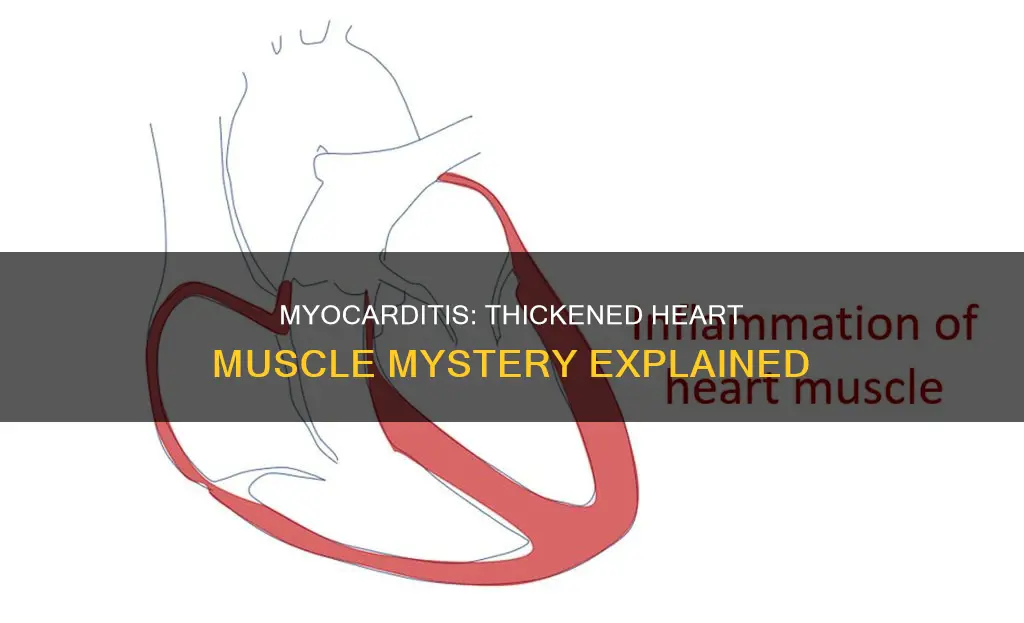 does myocarditis cause thickened heart muscle