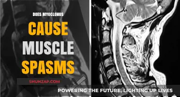 Myoclonus and Muscle Spasms: What's the Connection?