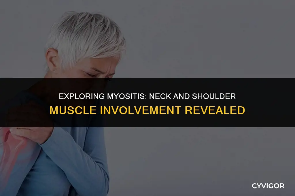 does myositis affect muscles in your neck and shoulders