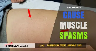Myositis and Muscle Spasms: What's the Link?
