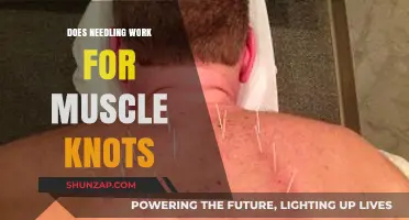 Does Needling Work for Muscle Knots? Unraveling the Truth