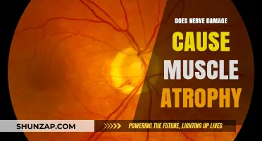 Nerve Damage and Muscle Atrophy: Understanding the Link