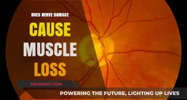 Nerve Damage and Muscle Loss: Understanding the Link