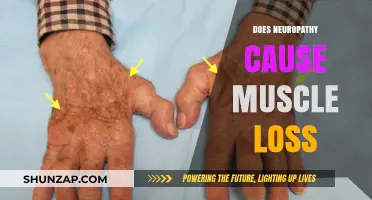Neuropathy and Muscle Loss: What's the Connection?