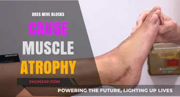 Neve Blocks: A Muscular Atrophy Risk?