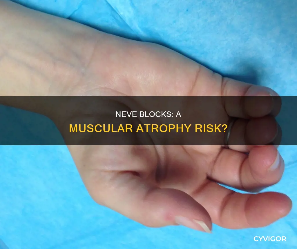 does neve blocks cause muscle atrophy