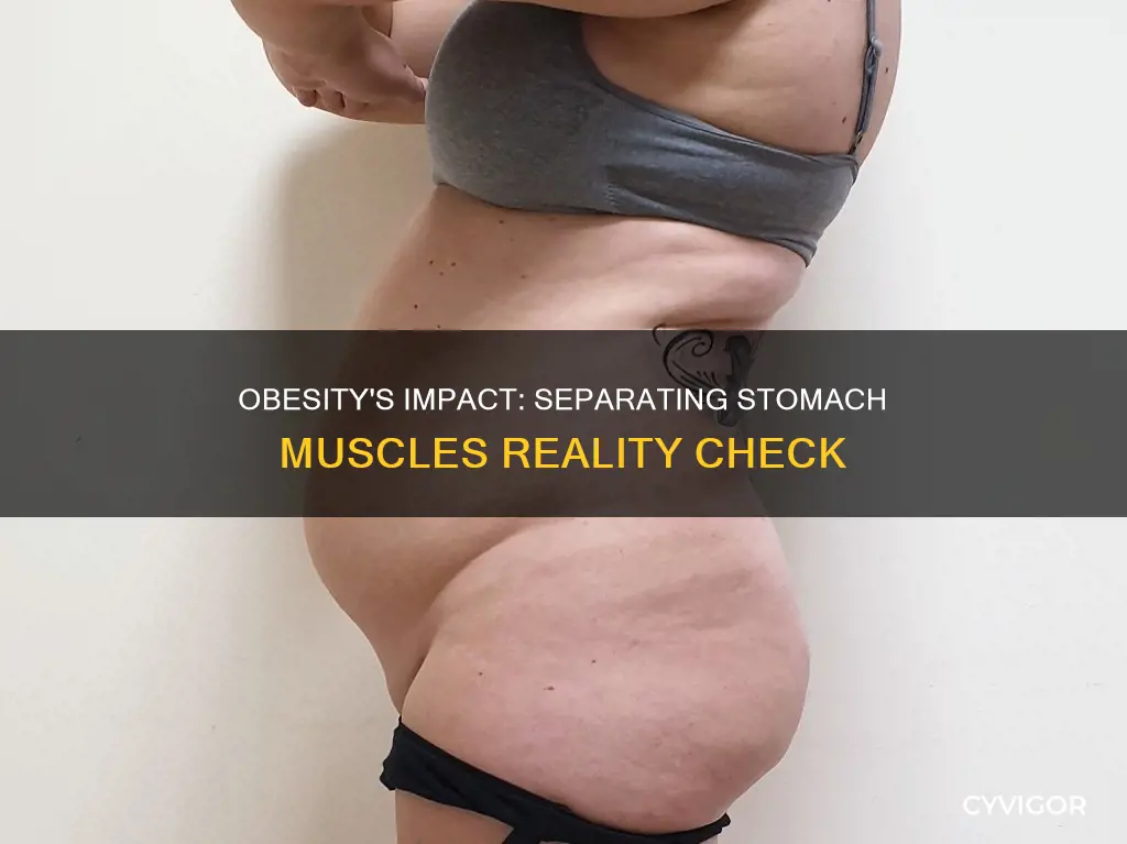 does obesity cause your stomach muscles to separate