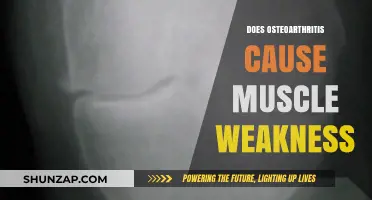 Osteoarthritis and Muscle Weakness: What's the Connection?