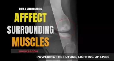 Osteonecrosis: Impact on Neighboring Muscles and Treatment Options