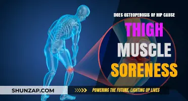 Thigh Pain and Osteoporosis: What's the Link?