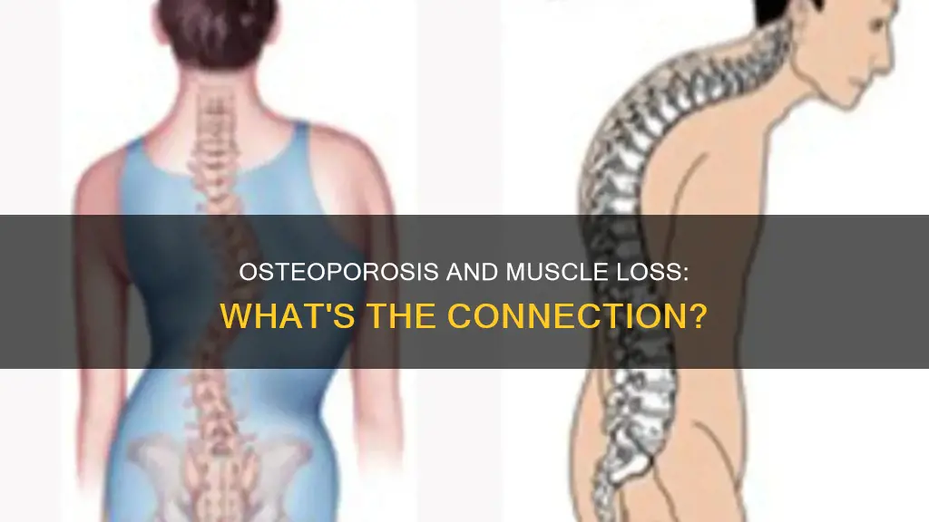 does osteoporosis causes muscle loss