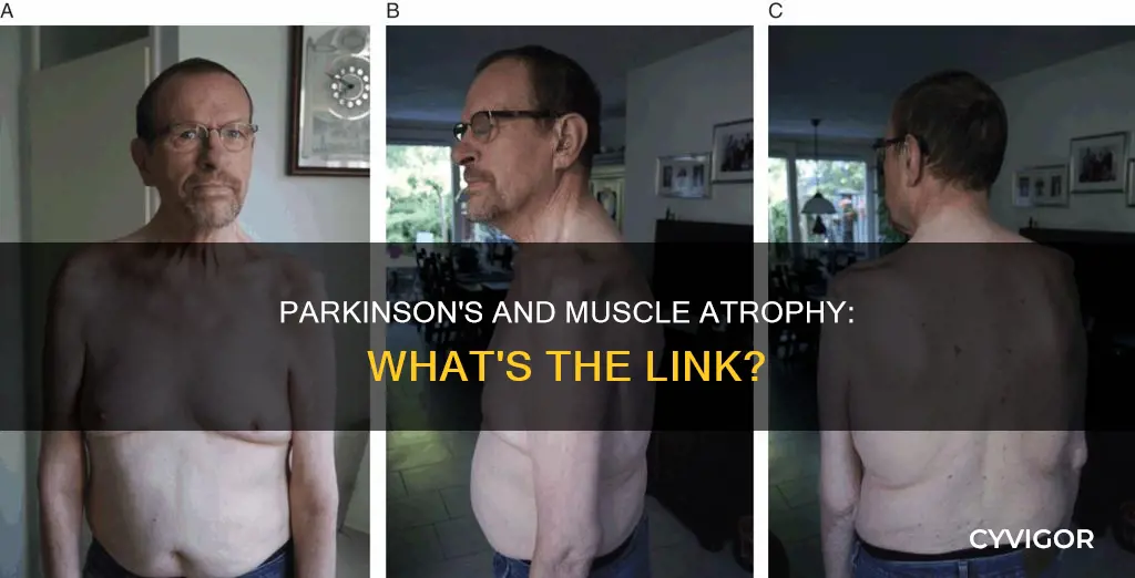 does parkinson