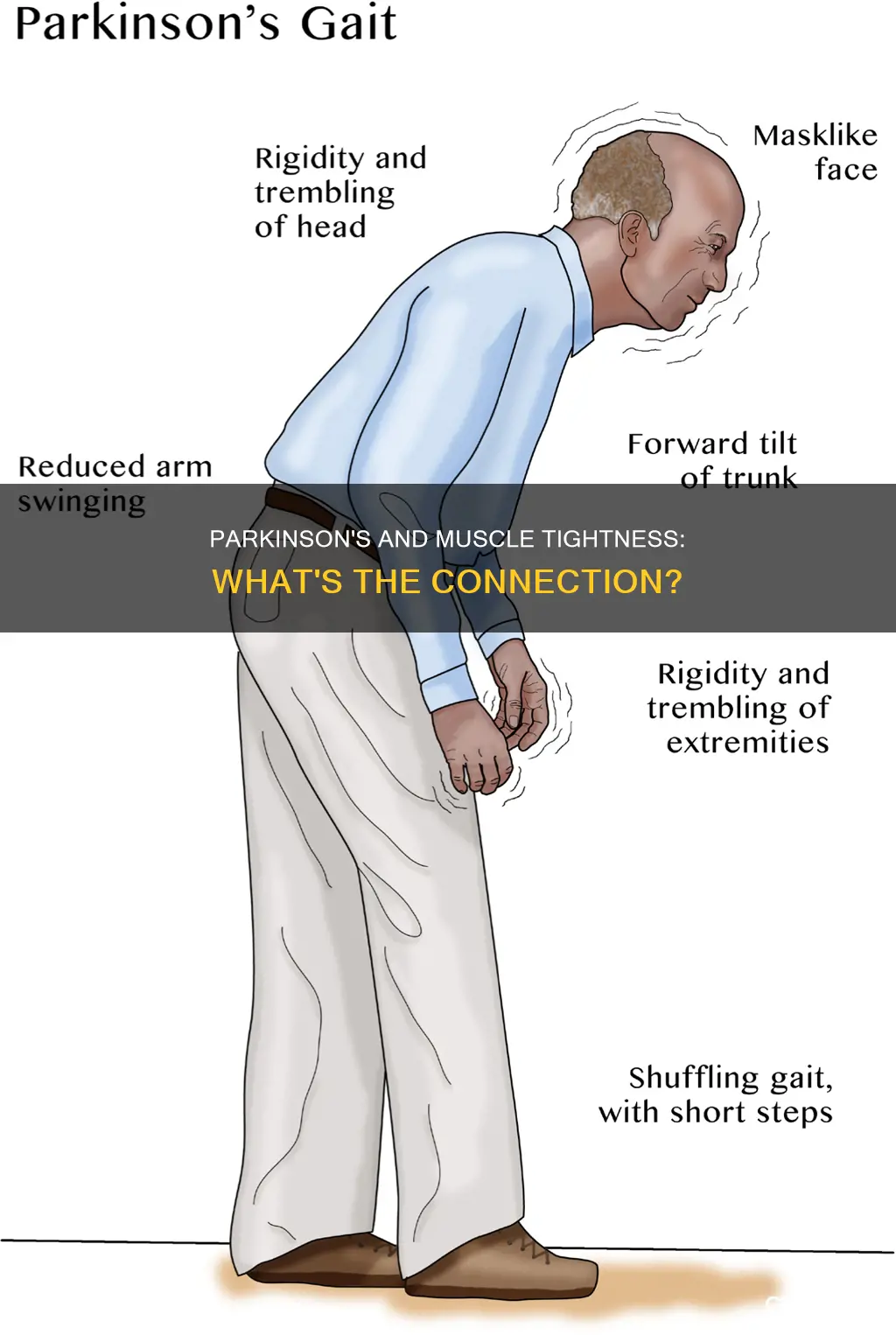 does parkinson