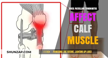 Exploring the Link: Patellar Tendonitis and Calf Muscle Impact