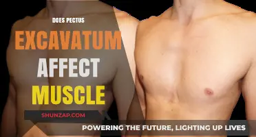 Exploring the Impact of Pectus Excavatum on Muscular Development and Function