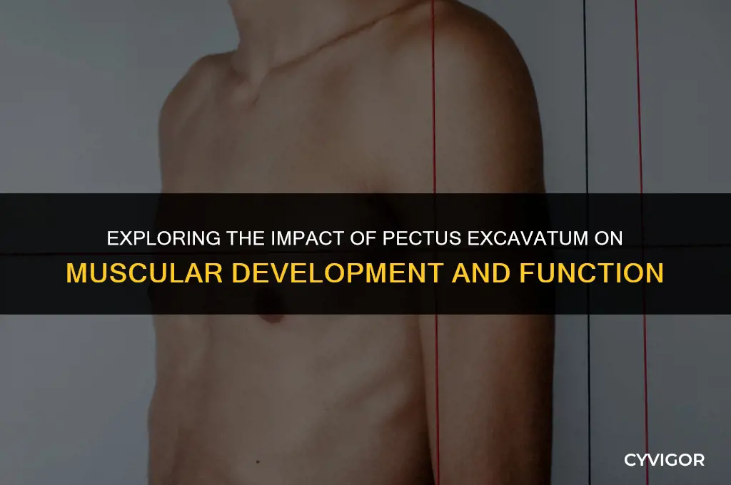 does pectus excavatum affect muscle