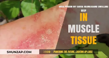 Poison Ivy: Deep Muscle Redness and Swelling?