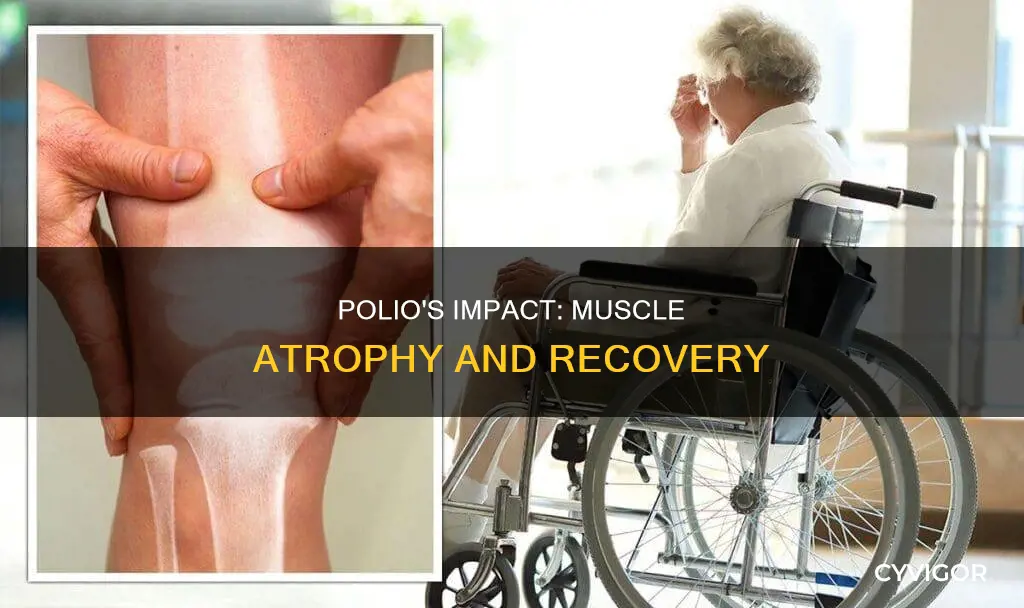 does polio cause muscle atrophy