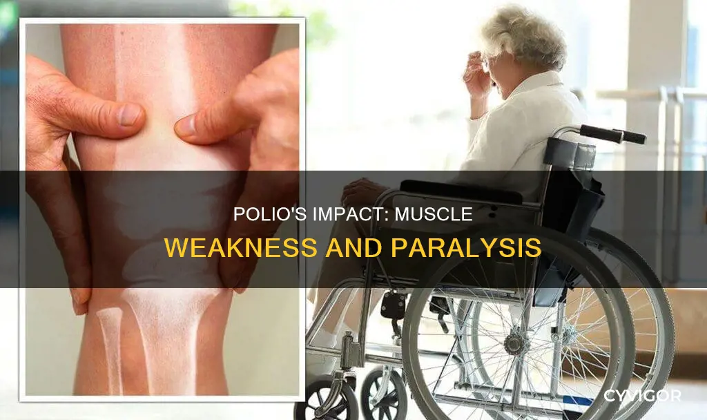 does polio cause muscle weakness