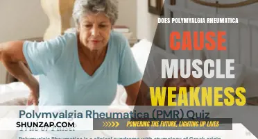 Polymyalgia Rheumatica: Understanding Muscle Weakness