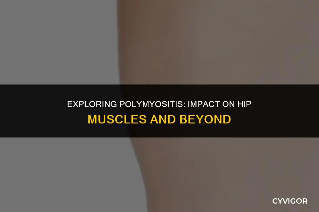 does polymyositis affect hip muscles