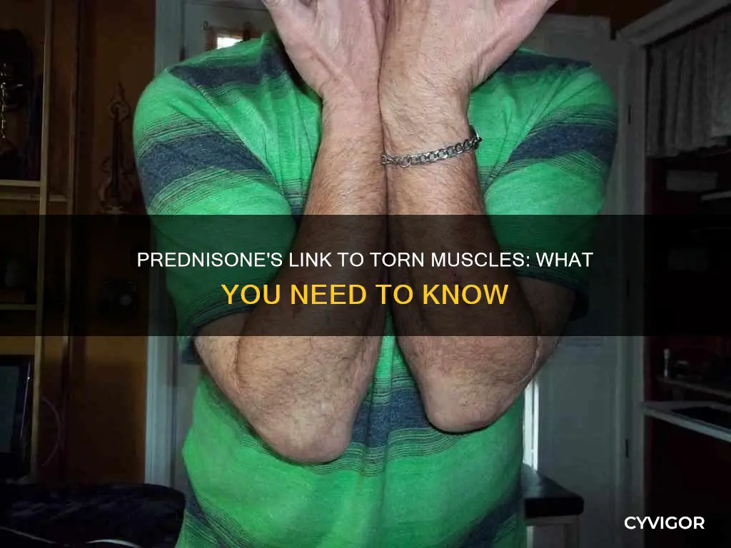 does prednisone cause torn muscles