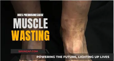 Prednisone and Muscle Wasting: What's the Real Story?