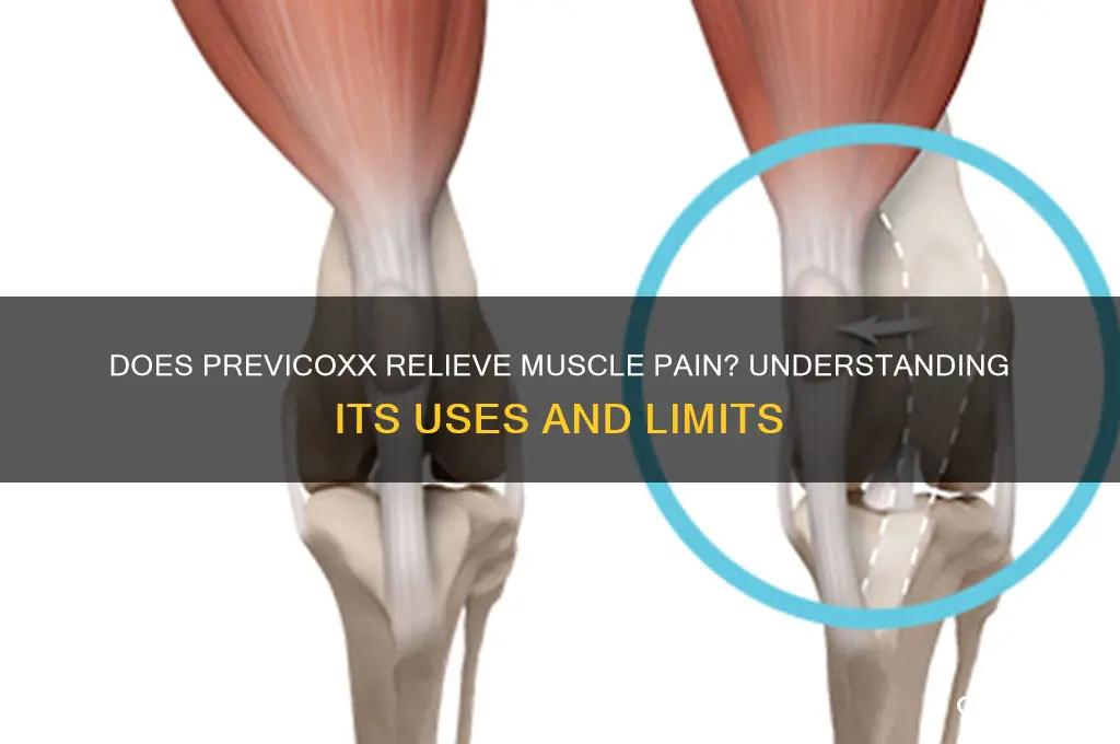 does previcoxx treat muscle pain